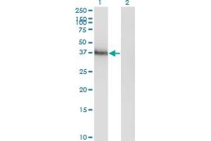 Western Blot analysis of HOXA11 expression in transfected 293T cell line by HOXA11 monoclonal antibody (M05), clone 8B8. (Homeobox A11 抗体  (AA 60-166))