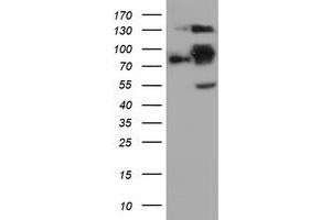 Western Blotting (WB) image for anti-Folate Hydrolase (Prostate-Specific Membrane Antigen) 1 (FOLH1) antibody (ABIN1500455) (PSMA 抗体)