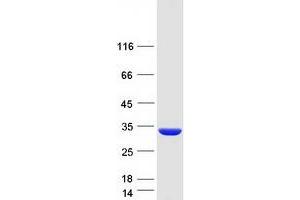 Western Blotting (WB) image for Crystallin, beta B3 (CRYbB3) protein (Myc-DYKDDDDK Tag) (ABIN2715240)