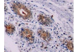 Immunohistochemistry (IHC) image for anti-B-Cell CLL/lymphoma 2 (BCL2) (AA 2-211) antibody (ABIN7432577)