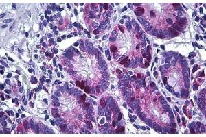 Human Small Intestine: Formalin-Fixed, Paraffin-Embedded (FFPE) (KIFC1 抗体  (AA 53-152))