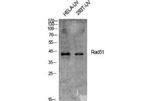 Western Blot (WB) analysis of specific cells using Rad51 Polyclonal Antibody. (RAD51 抗体  (Thr555))