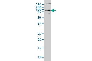 Western Blotting (WB) image for anti-Hedgehog Interacting Protein (HHIP) (AA 21-120) antibody (ABIN566261)