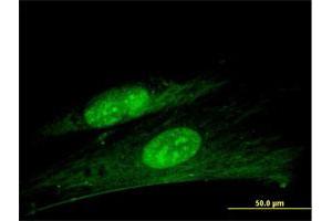 Immunofluorescence of purified MaxPab antibody to ANKRD7 on Hs 181. (ANKRD7 抗体  (AA 1-201))