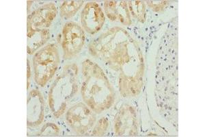 Immunohistochemistry of paraffin-embedded human kidney tissue using ABIN7163421 at dilution of 1:100 (PSPH 抗体  (AA 1-225))