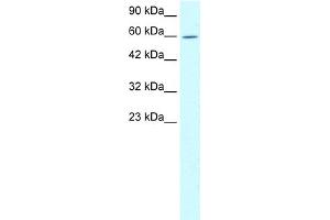 WB Suggested Anti-TRIM15 Antibody Titration:  1. (TRIM15 抗体  (N-Term))