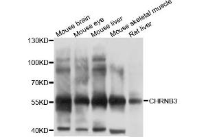Western blot analysis of extracts of various cell lines, using CHRNB3 antibody (ABIN4903288) at 1:1000 dilution. (CHRNB3 抗体)