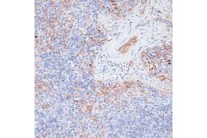 Immunohistochemistry of paraffin-embedded mouse spleen using Cathepsin G antibody (ABIN6127686, ABIN6139228, ABIN6139230 and ABIN6217069) at dilution of 1:100 (40x lens). (Cathepsin G 抗体  (AA 75-190))