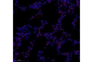 Immunofluorescence of paraffin embedded rat lung using tfiib (ABIN7074034) at dilution of 1: 500 (300x lens) (GTF2B 抗体)