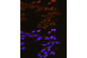 Immunofluorescence analysis of NIH-3T3 cells using DNM2 Rabbit pAb (ABIN6127773, ABIN6139741, ABIN6139742 and ABIN6223876) at dilution of 1:100 (40x lens). (DNM2 抗体  (AA 607-866))