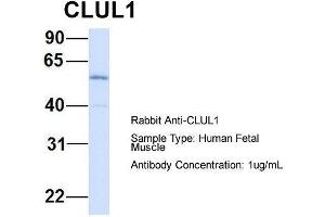 Host: Rabbit  Target Name: CLUL1  Sample Tissue: Human Fetal Muscle  Antibody Dilution: 1. (CLUL1 抗体  (Middle Region))