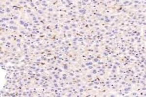 Immunohistochemistry of paraffin embedded mouse liver using F480 (ABIN7073801) at dilution of 1:1200 (200x lens) (F4/80 抗体)