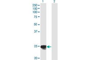 Western Blot analysis of YKT6 expression in transfected 293T cell line by YKT6 monoclonal antibody (M03), clone 1F8. (YKT6 抗体  (AA 99-198))