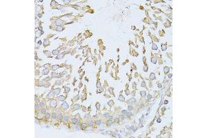 Immunohistochemistry of paraffin-embedded rat testis using HSPA5 antibody.