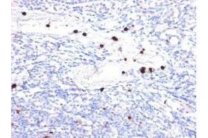 Image no. 1 for anti-Colony Stimulating Factor 3 (Granulocyte) (CSF3) antibody (ABIN6161622) (G-CSF 抗体)