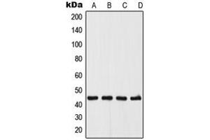 Western blot analysis of UGCG expression in A375 (A), MCF7 (B), Raw264. (UGCG 抗体  (N-Term))