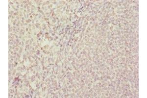 Immunohistochemistry of paraffin-embedded human tonsil tissue using ABIN7172439 at dilution of 1:100 (SUPT4H 抗体  (AA 1-117))