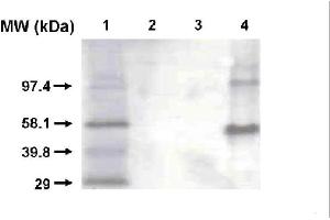 Western blot using CYP1A2 antibody . (CYP1A2 抗体)
