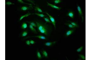 Immunofluorescence staining of Hela cells with ABIN7142198 at 1:200, counter-stained with DAPI. (PSMD1 抗体  (Regulatory Subunit 10))