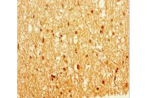 Immunohistochemistry of paraffin-embedded human brain tissue using ABIN7157846 at dilution of 1:100 (EPM2A 抗体  (Isoform 9))