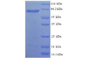 SDS-PAGE (SDS) image for phosphatidylserine Decarboxylase (PISD) (AA 1-375), (Isoform 2) protein (His-SUMO Tag) (ABIN5711877)