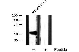 Western blot analysis of Keratin 8 phosphorylation expression in Mouse brain tissue lysates,The lane on the left is treated with the antigen-specific peptide. (KRT8 抗体  (pSer432))