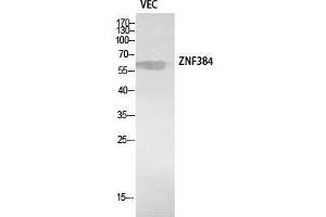 Western Blot (WB) analysis of VEC cells using ZNF384 Polyclonal Antibody. (ZNF384 抗体  (Internal Region))