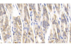 Detection of MCP1 in Mouse Stomach Tissue using Polyclonal Antibody to Monocyte Chemotactic Protein 1 (MCP1) (CCL2 抗体  (AA 24-96))