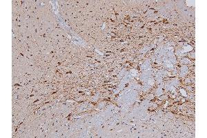 ABIN6267325 at 1/200 staining Rat brain tissue sections by IHC-P. (Tyrosine Hydroxylase 抗体  (pSer31))