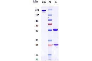 Anti-DLK1 Reference Antibody (LIV-1205) on SDS-PAGE under reducing (R) condition. (Recombinant DLK1 抗体)
