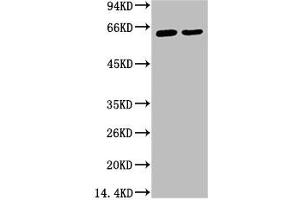 Western blot analysis of 1) Hela, 2) HepG2, diluted at 1:2000. (KRT6A 抗体)