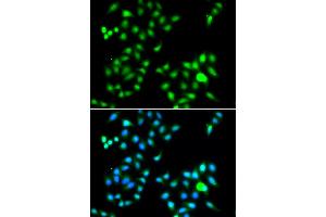 Immunofluorescence analysis of A549 cells using TWIST1 antibody (ABIN4905524). (TWIST1 抗体)