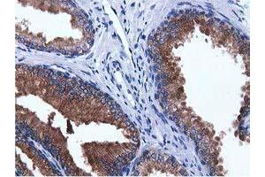 Immunohistochemical staining of paraffin-embedded Human prostate tissue using anti-ADI1 mouse monoclonal antibody. (ADI1 抗体)