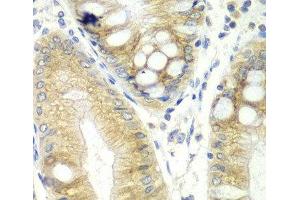 Immunohistochemistry of paraffin-embedded Human colon using CES2 Polyclonal Antibody at dilution of 1:100 (40x lens). (CES2 抗体)