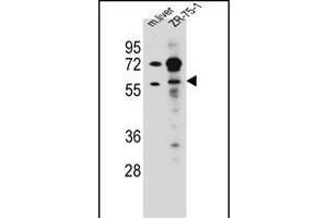 TRIM62 Antibody (C-term) (ABIN657216 and ABIN2837911) western blot analysis in mouse liver tissue and ZR-75-1 cell line lysates (35 μg/lane). (TRIM62 抗体  (C-Term))