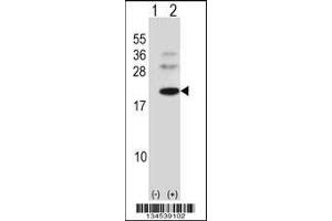 Western blot analysis of BARX1 using rabbit polyclonal BARX1 Antibody using 293 cell lysates (2 ug/lane) either nontransfected (Lane 1) or transiently transfected (Lane 2) with the BARX1 gene. (BARX1 抗体  (C-Term))
