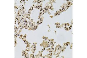 Immunohistochemistry of paraffin-embedded rat lung using FGF2 antibody. (FGF2 抗体)