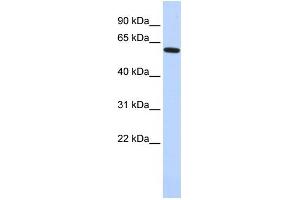 Western Blotting (WB) image for anti-Eyes Absent Homolog 1 (EYA1) (Middle Region) antibody (ABIN2779640)