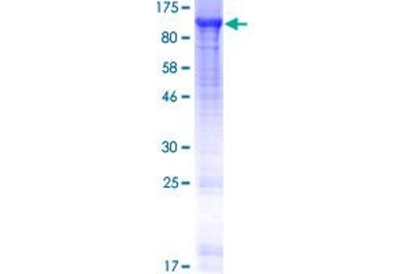 AMPD1 Protein (AA 1-747) (GST tag)