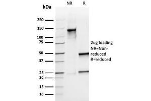 SDS-PAGE Analysis Purified S100A9 Recombinant Mouse Monoclonal Antibody (rMAC3781). (Recombinant S100A8 抗体)