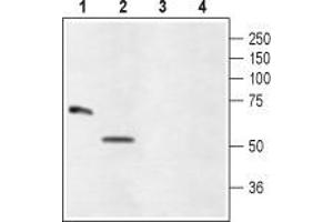 Western blot analysis of rat eye (lanes 1 and 3) and ARPE-19 (lanes 2 and 4) lysates: - 1,2. (GLRA4 抗体  (Extracellular))