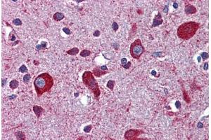 Human Brain, Cortex: Formalin-Fixed, Paraffin-Embedded (FFPE) (LRP8 抗体  (AA 395-444))