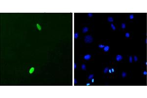 Immunocytochemistry/Immunofluorescence analysis using Mouse Anti-DUX4 Monoclonal Antibody, Clone P2B1 (ABIN863109). (DUX4 抗体  (C-Term))