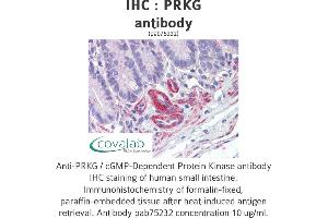 Image no. 1 for anti-PRKG antibody (ABIN1738352) (PRKG 抗体)