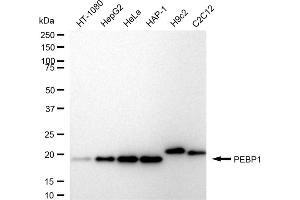 Western blotting analysis using PEBP1 antibody (ABIN7799790).