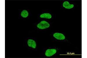 Immunofluorescence (IF) image for anti-Activating Transcription Factor 2 (ATF2) antibody (ABIN2752055)