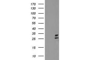 HEK293T cells were transfected with the pCMV6-ENTRY control (Left lane) or pCMV6-ENTRY CXorf26 (Right lane) cDNA for 48 hrs and lysed. (CXorf26 抗体)