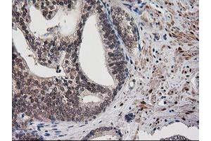 Image no. 1 for anti-Destrin (Actin Depolymerizing Factor) (DSTN) antibody (ABIN1497908) (Destrin 抗体)