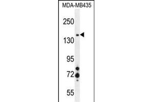 MET Antibody (ABIN1881539 and ABIN2845394) western blot analysis in MDA-M cell line lysates (35 μg/lane). (c-MET 抗体)