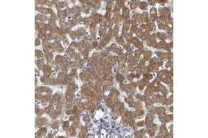 Immunohistochemical staining of human liver with LYSMD1 polyclonal antibody  shows moderate cytoplasmic positivity in hepatocytes. (LYSMD1 抗体)